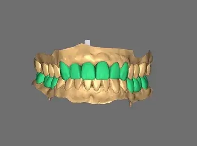 Trust Your CAD/CAM Design to Dental Designers
