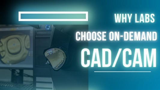 Why More Dental Labs Are Choosing On-Demand CAD/CAM Design Services